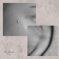 /album/fotogalerie-piercing/microdermal-krcni-jamka-oblicej-jpg/